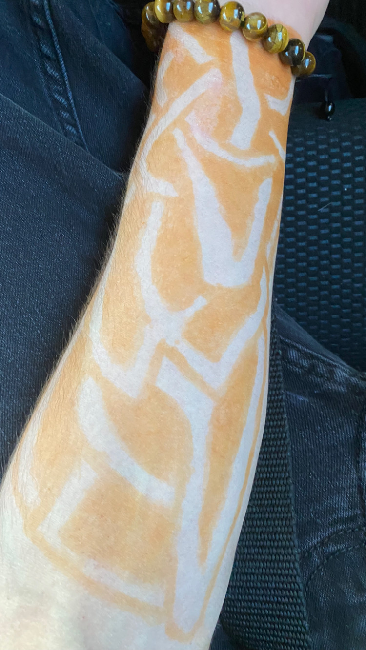 Marks Worn on Skin